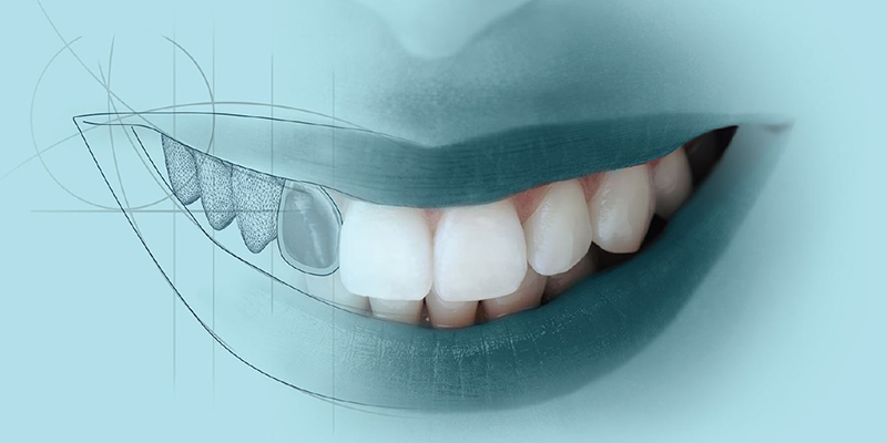 Digital Dental Fotoğraf ve Mock Up Uygulamaları